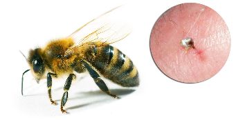 Del Hondrostrong vključujejo čebelji strup, ki izboljšuje presnovne procese v tkivih,